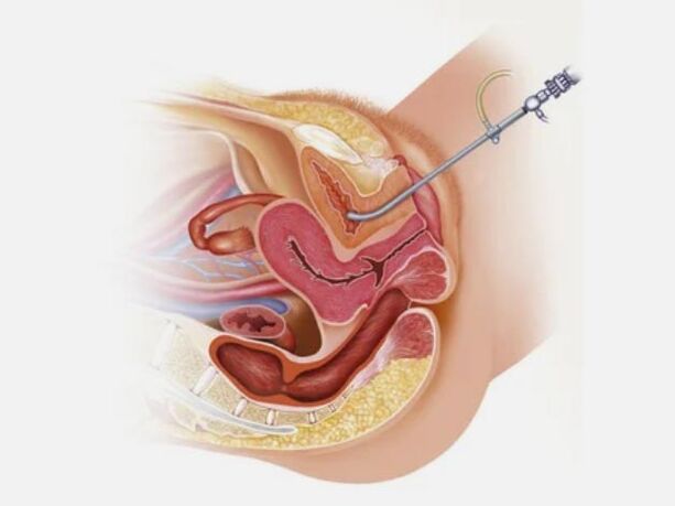 Cystitis diagnostics